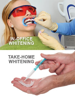 Whitening Options